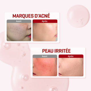 SNAIL TRUECICA MIRACLE REPAIR SERUM 50ML